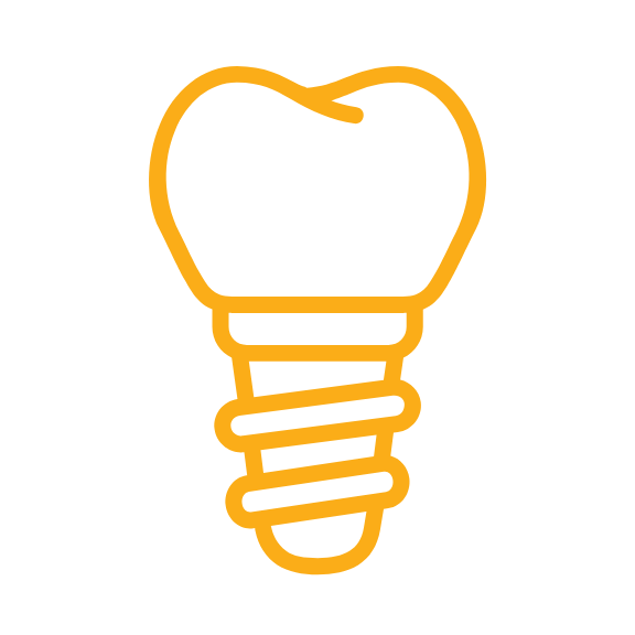 dental-implants-cleveland-solon